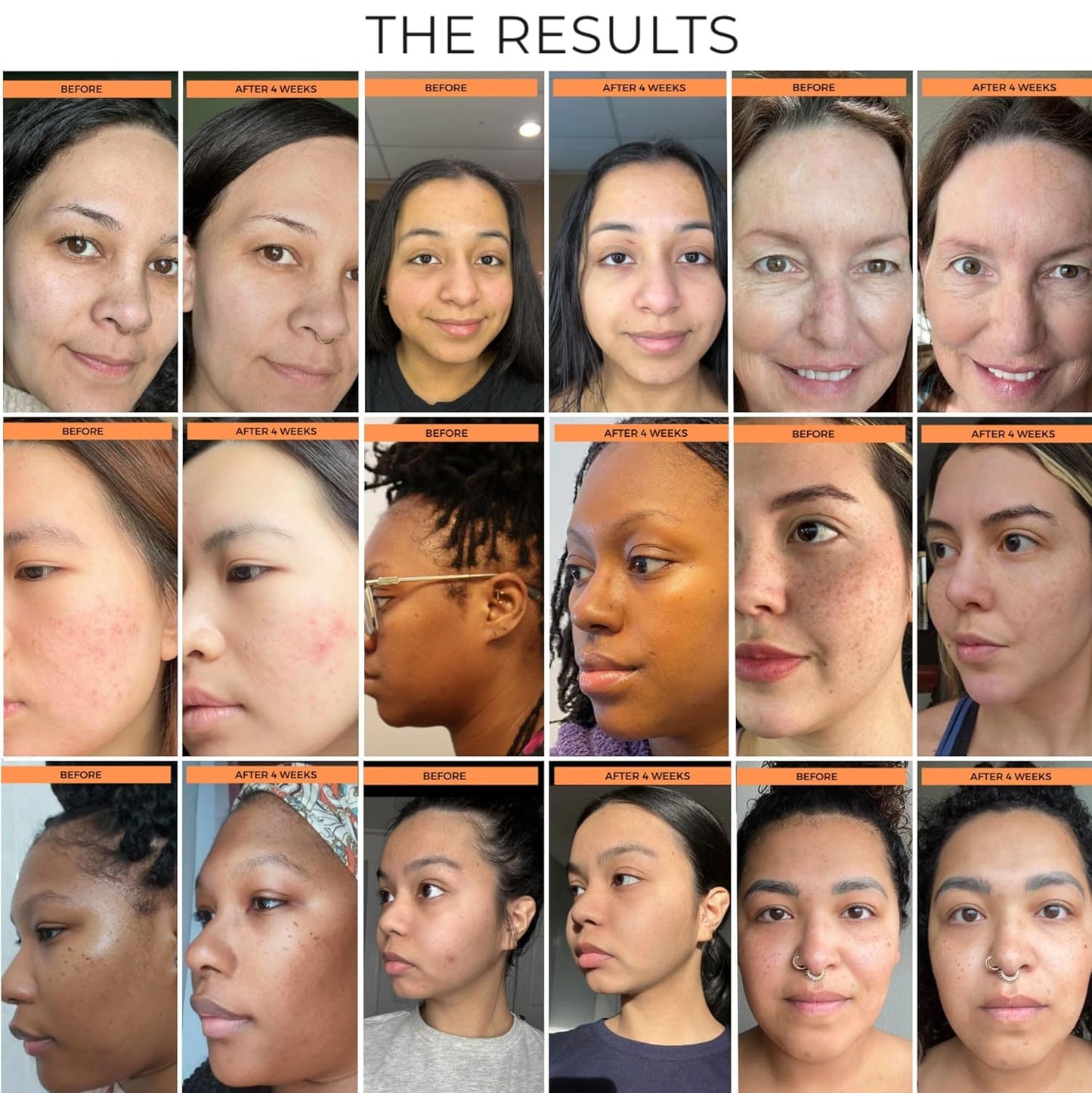 BeautyStat Universal C Skin Refiner, All Skins, 50ml